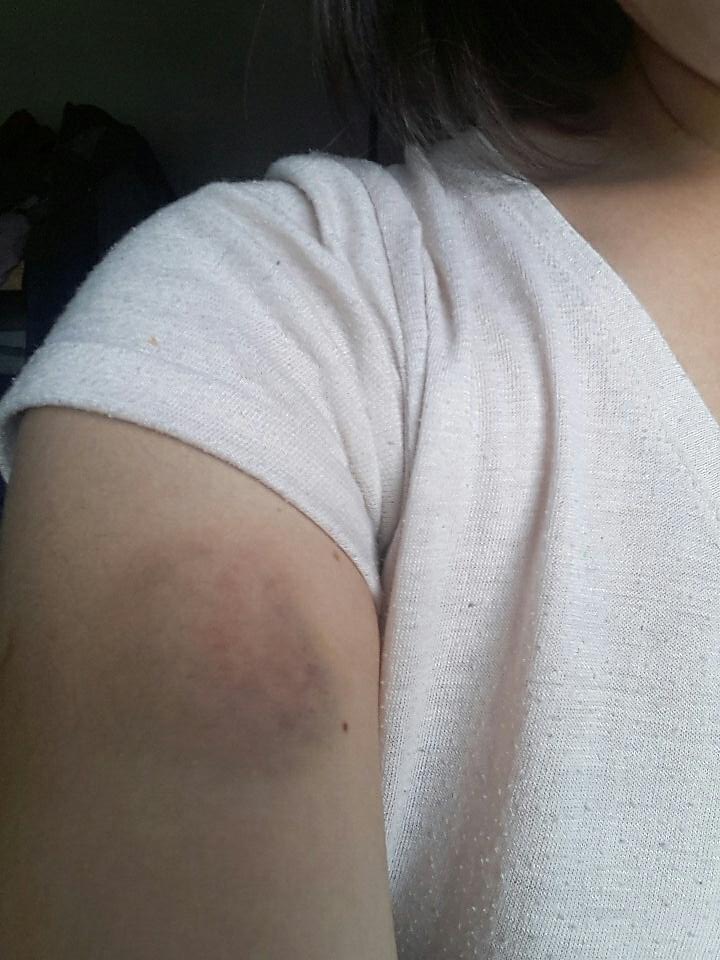 missmatildaa's tweet photo. Les juro q llore cuando Kata me mordió https://t.co/9T8RGu9eP3
