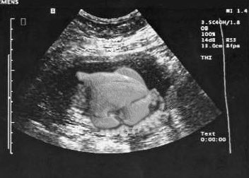TheOnlyCharlesB's tweet photo. I have an announcement 👶🏾 https://t.co/vnXO27VCCl