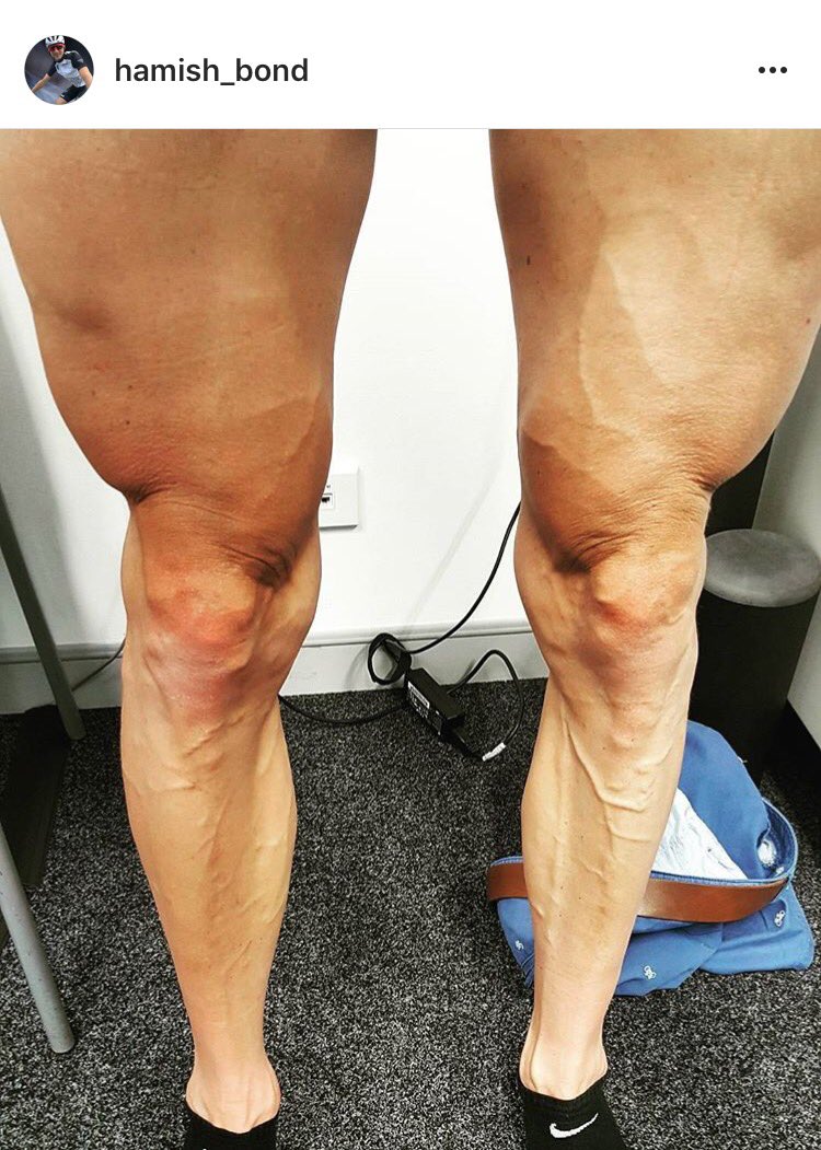 Hamish Bond's legs are perfect for Thanksgiving. <a href="/kiwipair/">KIWIPAIR-EricMurray</a> <a href="/drewginn/">Drew Ginn</a>