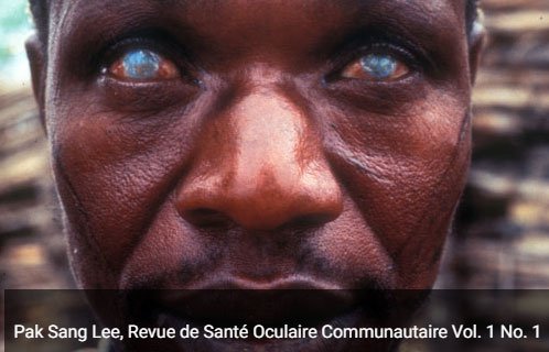 River blindness worm's genome read for 1st time by Sanger scientists <a href="/ChEMBL/">ChEMBL Database</a> shows existing drugs that could kill it bit.ly/2ffe1dx