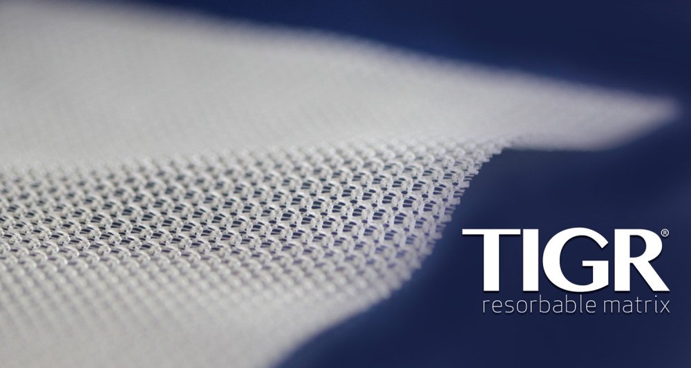 TIGR® Matrix tweet media