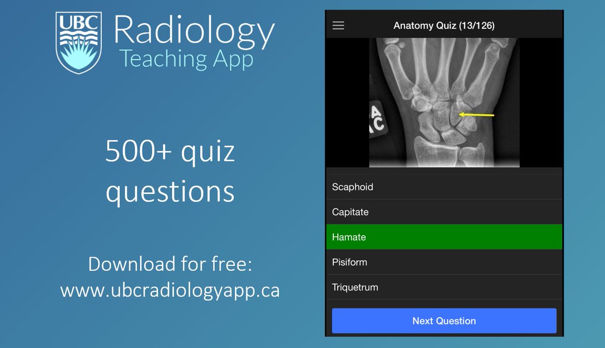 teachradiology's tweet photo. Learn anatomy with the UBC Radiology Teaching App! https://t.co/22qzScFQYJ @BACA_Anatomy @AACAnatomy @anatomymeeting @anat_soc #anatomy https://t.co/Rya0VByut5