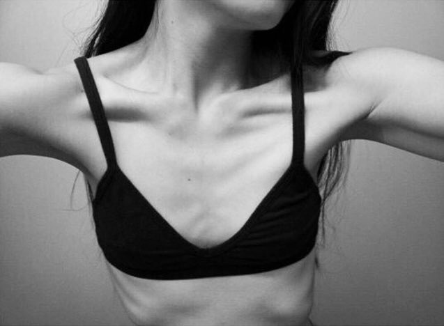 thinspirationlu's tweet image. #collarbones #chestbones #thinspo #skinny #legspo #thighgap #flatstomach
