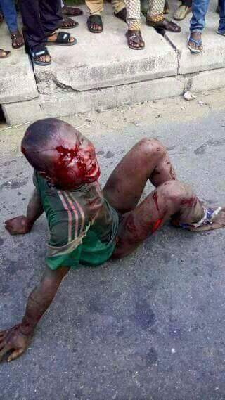 akhtarsagar44's tweet image. سات سال کی عمرکےبچےکوزندہ جلایاجاریاہےقصورصرف مسلمان ہونا
یہ سب آپکوپاکستان کاضمیرفروش اورشریف لوگوں کی پگڑیاں اچھالنےوالامیڈیانہیں دیکھاےگا