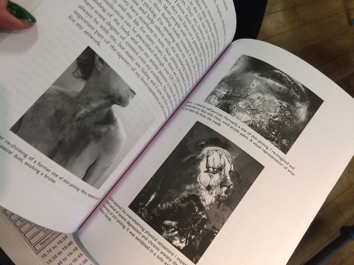 LizAtkin's tweet photo. Very proud to be a contributor with 30 others to a new book on Body Dysmorphia. Thank you @BDDFoundation #BDDF2016 #skinpicking https://t.co/qhuOfsRuje