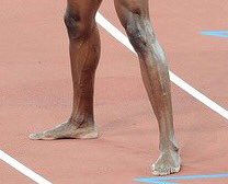 Retlouping's tweet photo. @Retlouping Mr Bolt sorry to tell you have flat feet and scoliosis of the spine. But good news we can fix that 😂😂😂😂😂😂😂#problemgivers https://t.co/bc0KF4r5QL