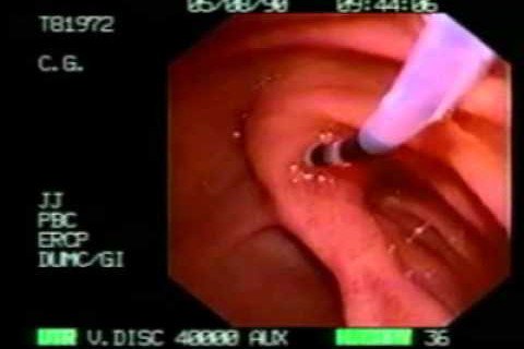 SAGES_Updates's tweet photo. ICYMI: An Unusual Case of Pacreatitis https://t.co/IveCFhVoSr https://t.co/i7Ddgyv0OX