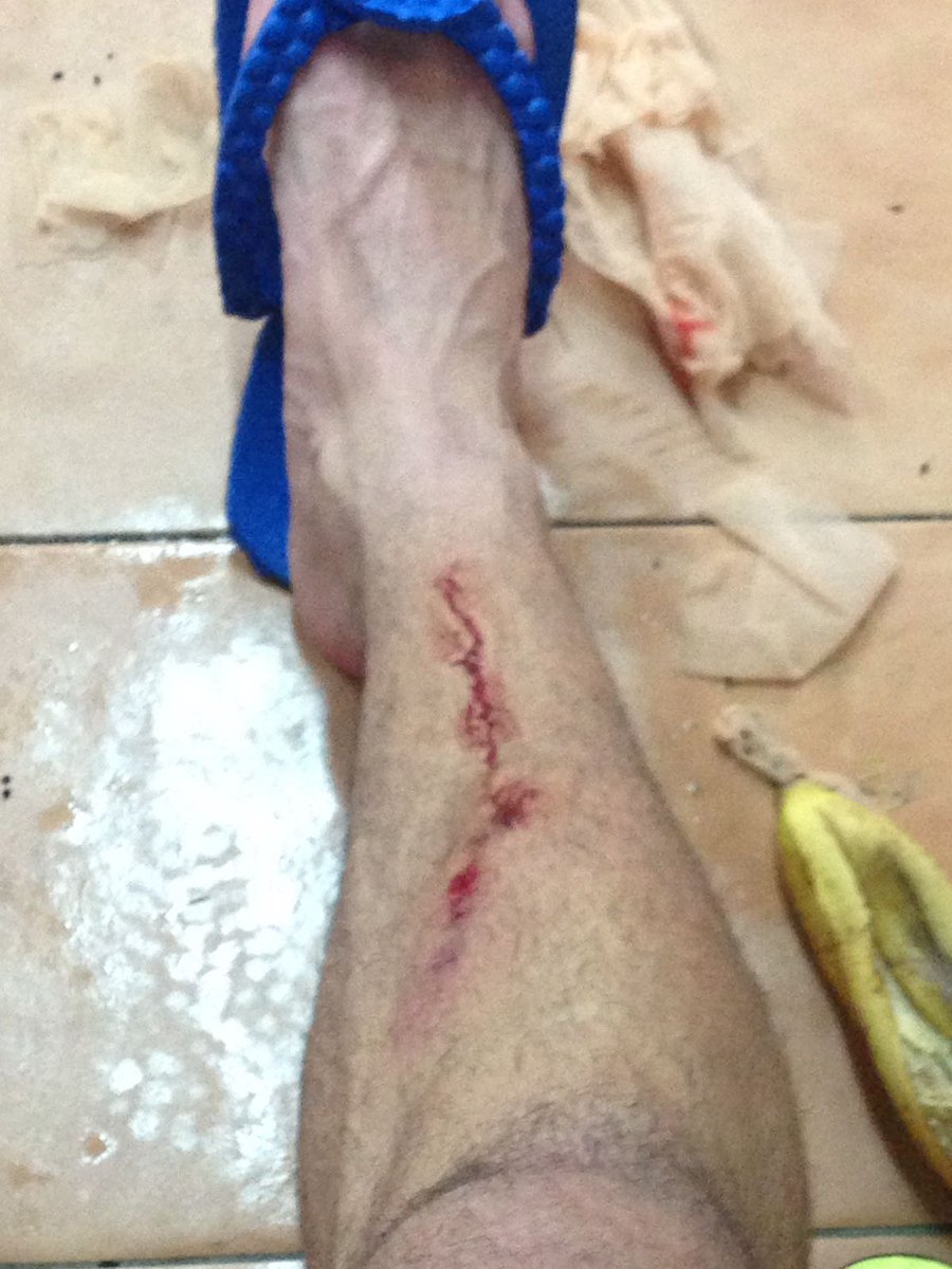 mirolois's tweet photo. el @AtcoSaguntino  solo se trae 1 pnto pero @Adrianus07  lo mismo se trae alguno mas y 1 tarjeta amarilla por no poner la rodilla vaya arbi https://t.co/ECEmbGYZiM