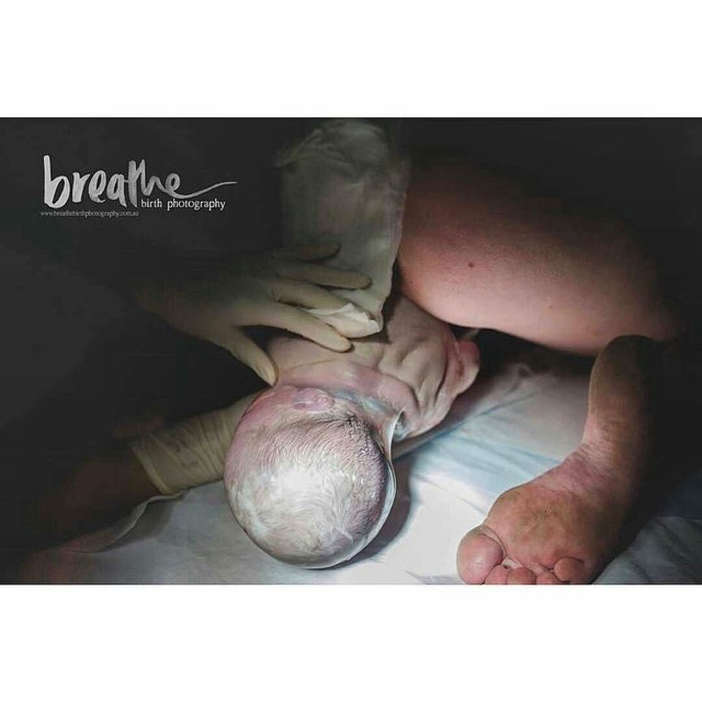 hypnobirthing4's tweet photo. Che foto meravigliosa! ❤ Nato con le membrane intatte, in posizione OP (occipito posterior… https://t.co/ieKUV3WuTM https://t.co/ATdjxBKF7s