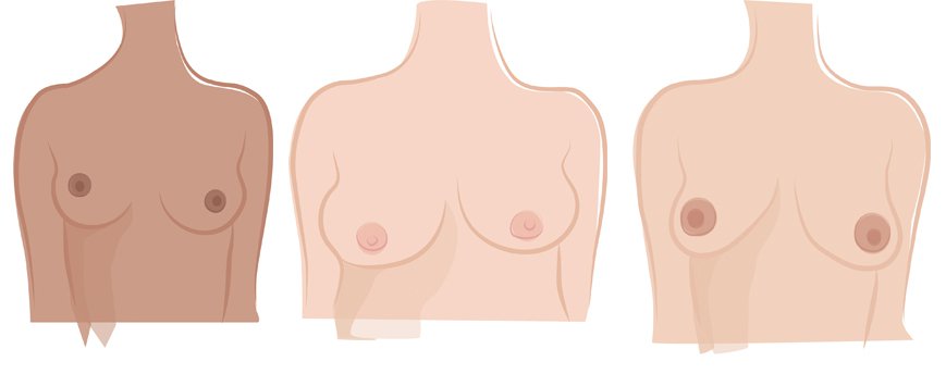 BreastCancerNow's tweet photo. Everyone's breast are different, so how can you know what is normal? https://t.co/MC0MTFasmd https://t.co/pKBOXJiLhE