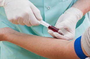 researz's tweet photo. Infusion of Young Blood into an Older Person Cannot Stop the Aging Process https://t.co/9BaT1Oi0yr #antiaging #infusionblood https://t.co/bdF6r2fQSn