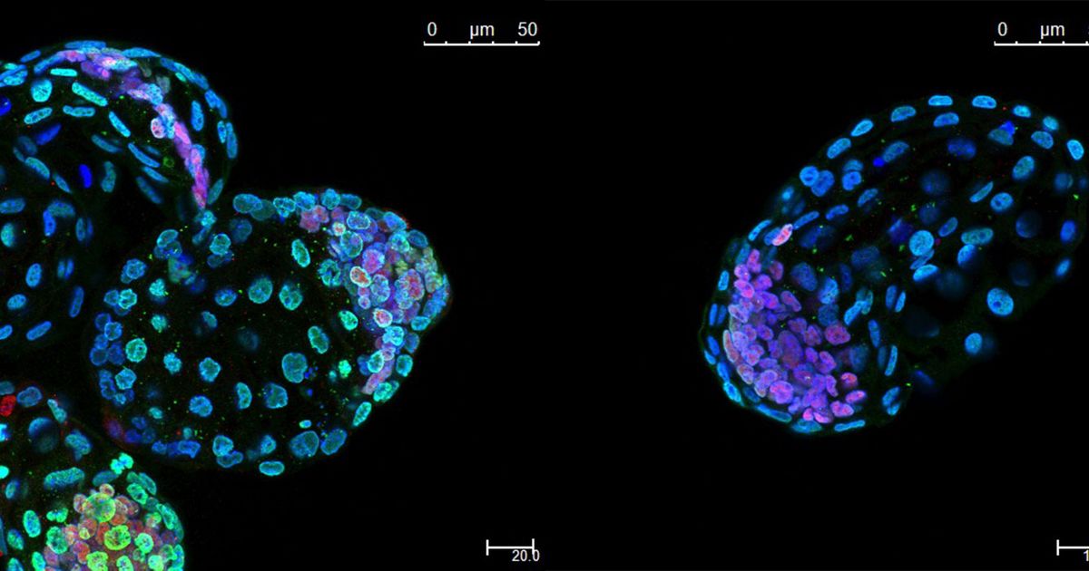 FactFictionPod's tweet photo. Scientists put mouse embryos in suspended animation for a month https://t.co/q8LLGwaJi5 https://t.co/Gke3h2Nwiz