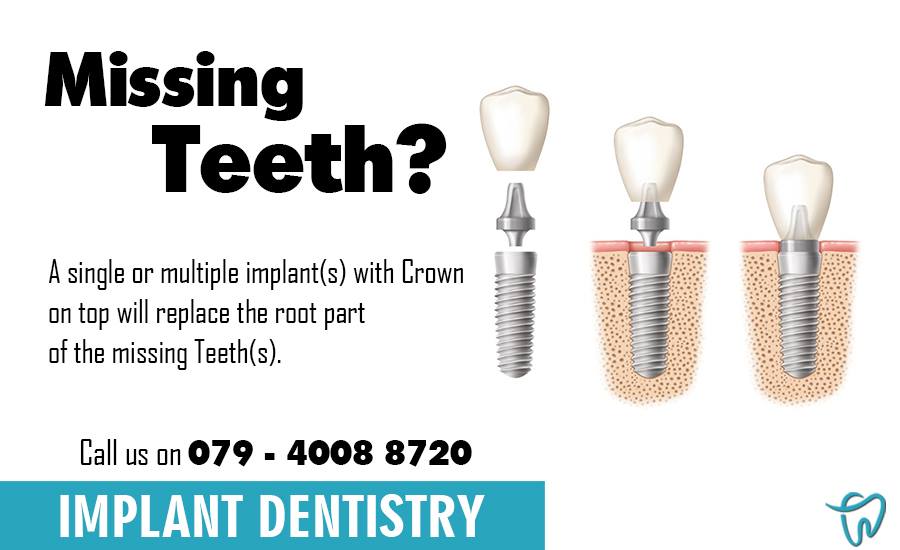 dr_nirali_scd's tweet photo. visit us : https://t.co/cjoRbCDtbs https://t.co/WUNvFLetyk