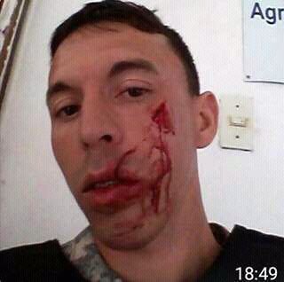 Roberto_Moar's tweet photo. Cuando vayan a opinar, recuerden que así quedó el funcionario policial agredido con una garrafa. https://t.co/FqwI9GROHp
