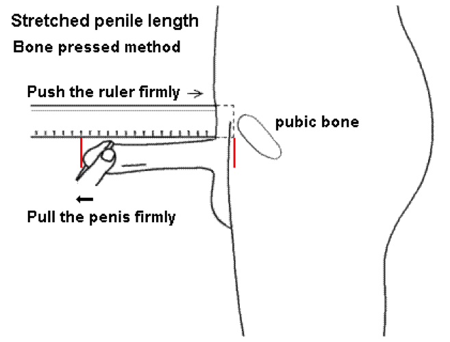 Bisa on Twitter: "Doctor, Please my penis is too small - article by ou...