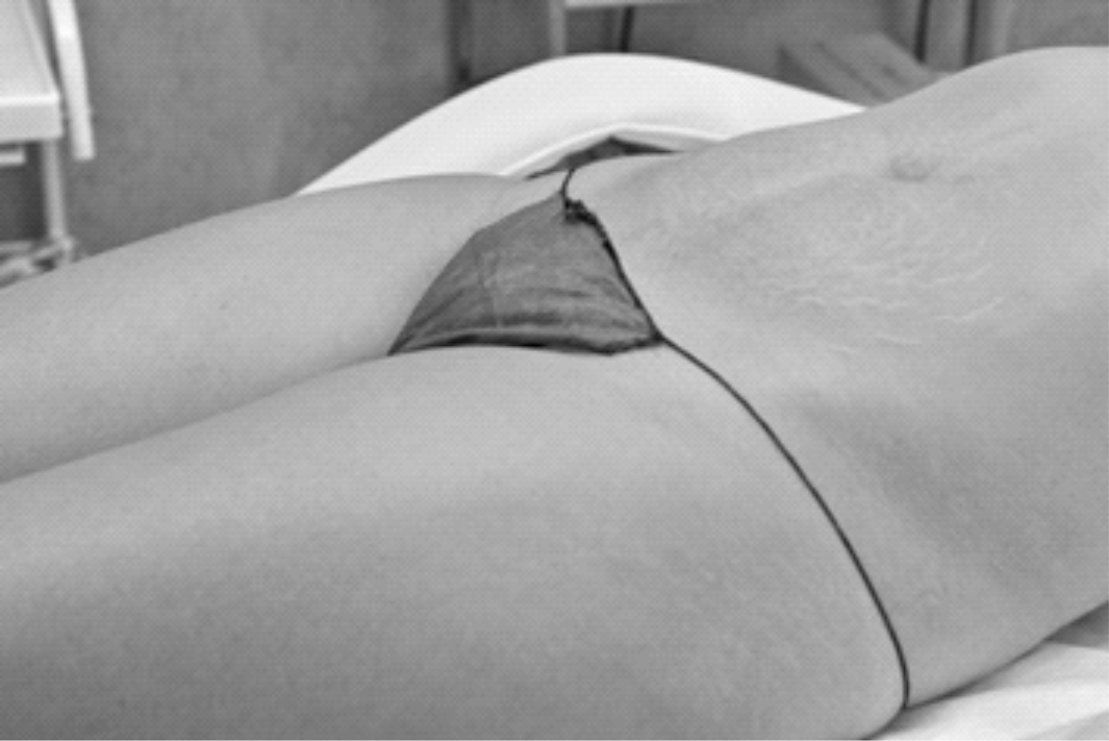 ChristineCBling's tweet photo. Though stretch marks are no cause for alarm,they can be a serious impediment to your lifestyle https://t.co/76GH9GlofY #DrChiu #TheBestYou https://t.co/bDFiwds8M3