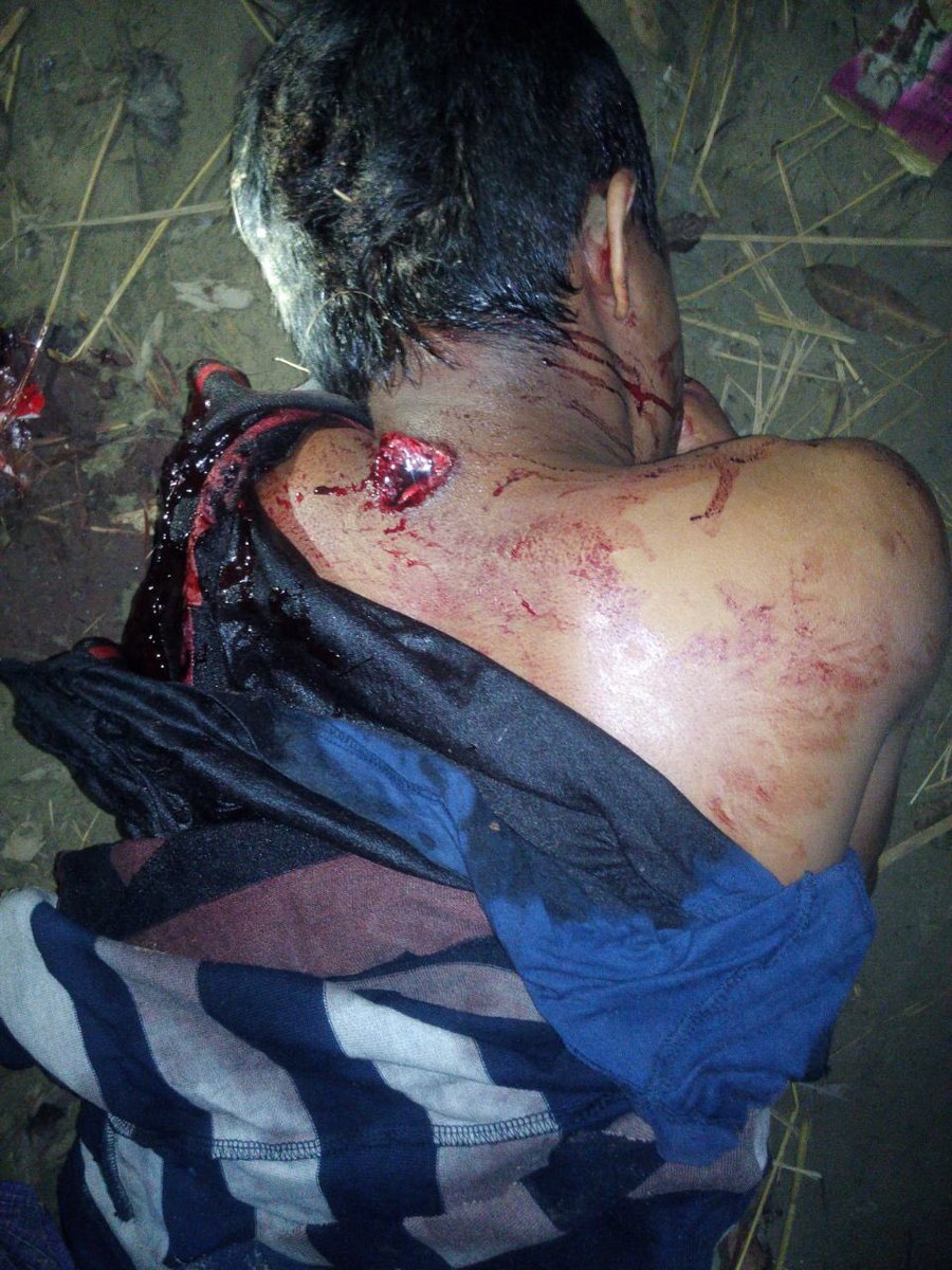 tunkhin80's tweet photo. A #Rohingya boy Anas (17yrs) just shot by #Myanmar Border Guard Force in #NgaKuRa a few hrs ago.UN mandated investigation needed urgently. https://t.co/2MqhvRix5U