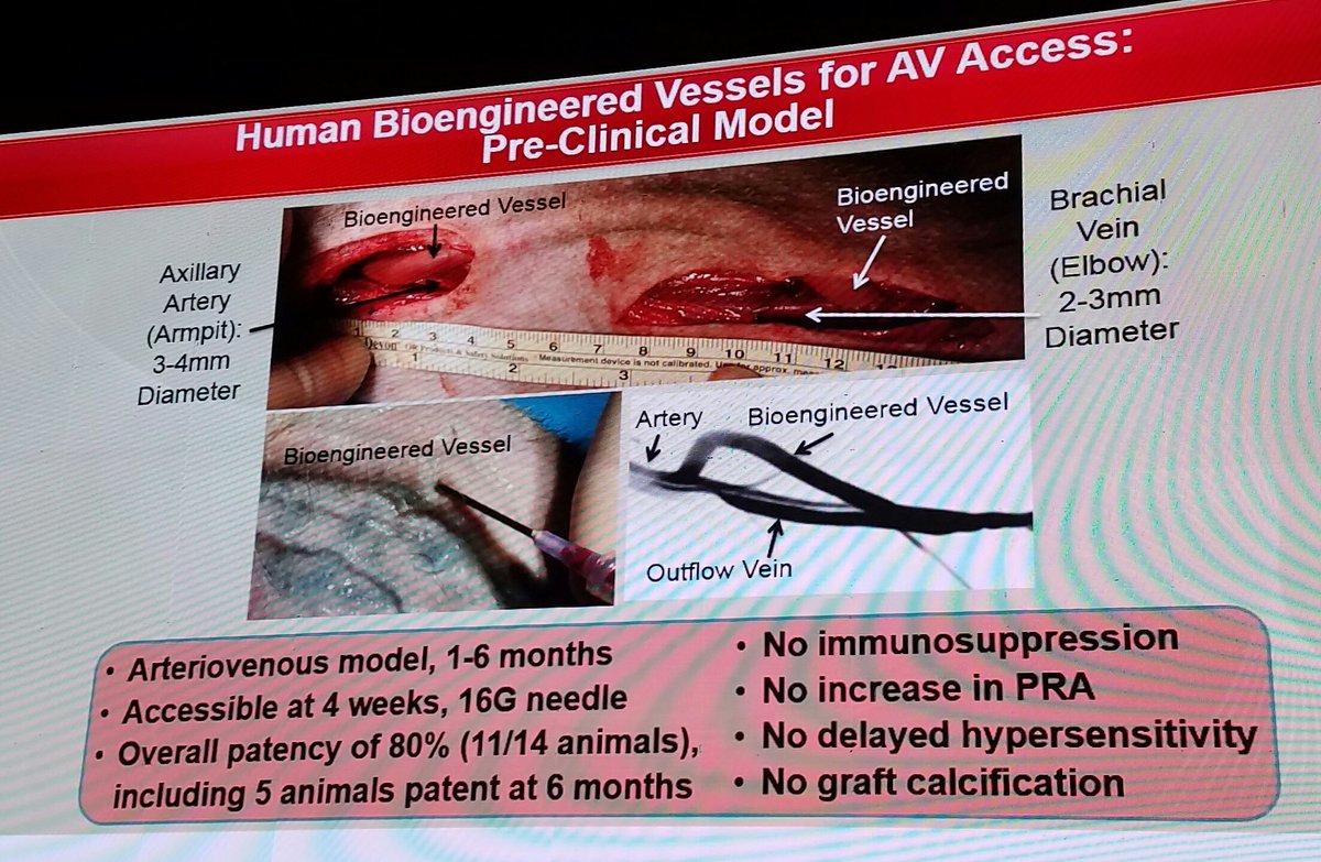Angiologist's tweet photo. Bioengineered vessels are promising for use as AV grafts #ICI2016 @EricTopol #nephrology https://t.co/dnb1k69v9k