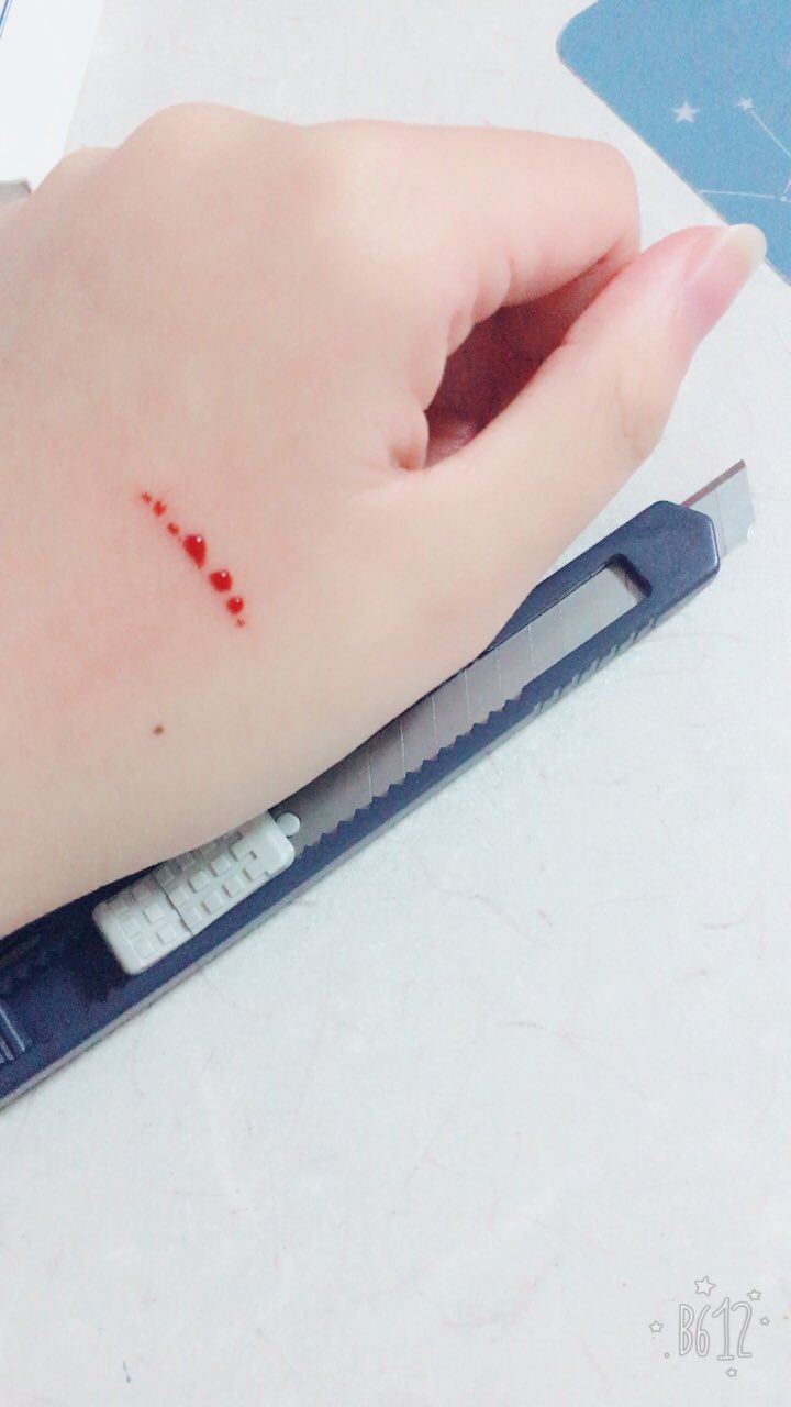 苺 完璧な仮面 病み垢 A Twitter とまらなくなる アムカ 自傷 自傷癖 病み垢さんと繋がりたい 病み垢さんフォロバする 病み垢さんrt