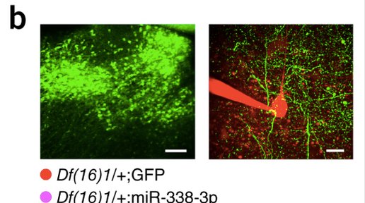 NatureMedicine's tweet photo. miR-338-3p depletion is necessary and sufficient to disrupt auditory thalamocortical signaling in 22q11DS mice: https://t.co/kxgBLAgm5z https://t.co/zMYU1lYyhD