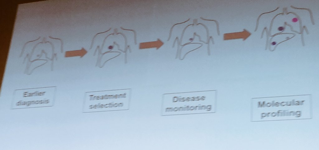PhilippaBrice's tweet photo. #personalisedmedicine  for cancer in a nutshell from Prof Nitzan Rosenfeld @CRUKCambridge - speaking on non-invasive technologies #LSS2016 https://t.co/mScbDpRWfC