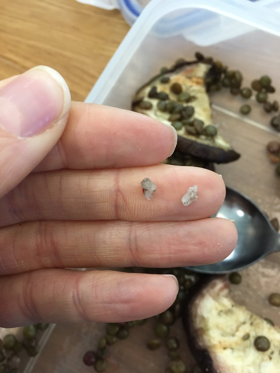 EmmaLeech1's tweet photo. @Tesco this is the 5th time I have found a stone in my lentils at lunch. Not happy https://t.co/nELDSYTJTZ