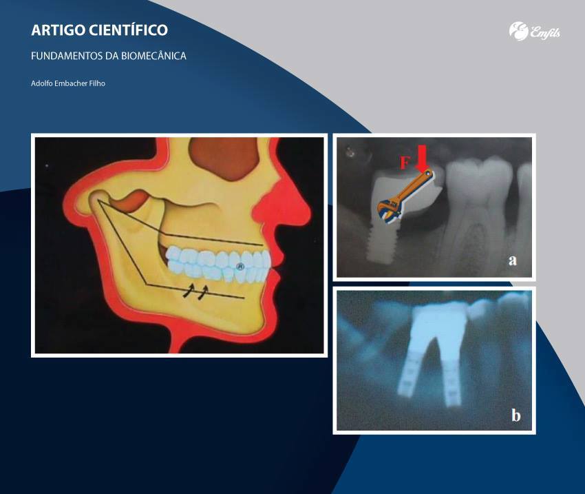 download herzkatheter: einsatz in diagnostik