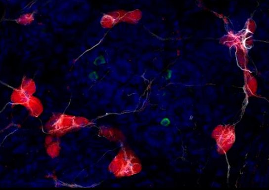 Anke van Eekelen (@uttersenselsc) on Twitter photo When looking beyond the brain for clues to Parkinson's, the gut-of all places-seemed a good start <a href="/ScienceNews/">Science News</a> ow.ly/17wJ306AoWQ When looking beyond the brain for clues to Parkinson's, the gut-of all places-seemed a good start <a href="/ScienceNews/">Science News</a> ow.ly/17wJ306AoWQ