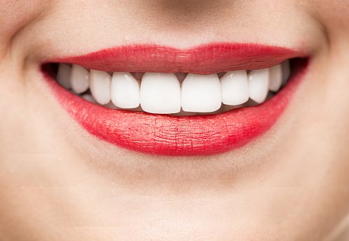 APDCongress's tweet photo. A supplement containing #Lactobacillus #rhamnosus could enhance #dental health by reducing tooth decay: https://t.co/xXSVtUaiCO https://t.co/an6nPMYYGk