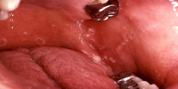 SimonovKassi's tweet photo. This Type Of Itching Results In Thinning Of Fur And Flaky Skin And More Or Less Associated https://t.co/yTbq4UOLGP https://t.co/l23tWl99I1