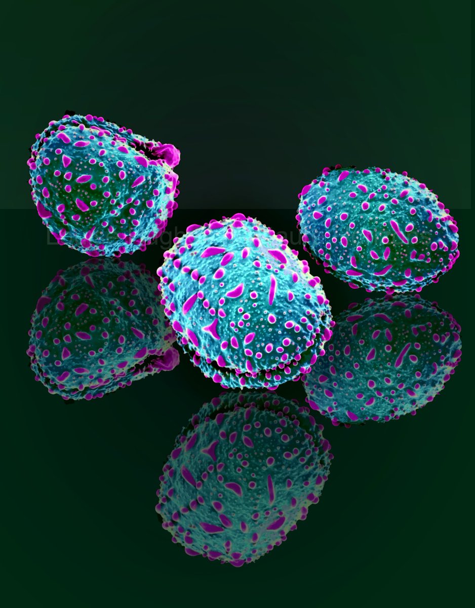 It is that time of year again! #microscopyadvent #1stdecember ##AdventCalendar SEM of Iris pollen grains #sciart <a href="/obu_bms/">Oxford Brookes BMS</a> <a href="/oxford_brookes/">Oxford Brookes University</a>