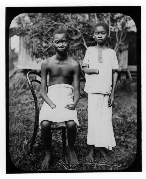 Gemma_Parellada's tweet photo. Del #caucho al #coltan.
1908.Colonia belga. Castigo a quienes no recogían suficiente caucho: (@HistoryInPix)
#ConnectCongo #Rdc #evictims https://t.co/tauCpvSHEO