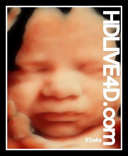 3Dand4Dtech's tweet photo. Planning a scan in the near future Book Now! bc appts. will be harder to get nearing Xmas & New Year #HDLive4D #3D4D #Pregnant #Ultrasound https://t.co/TGFL4Nlw01