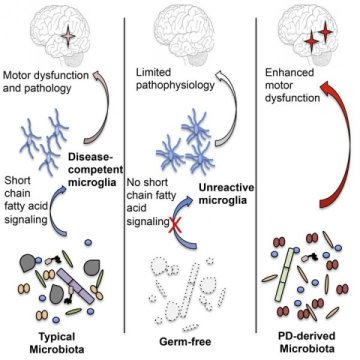 ScienceDaily's tweet photo. Parkinson's Disease Linked to Gut Microbiome https://t.co/RR6sfDXTj9 https://t.co/W1BzqYwBGN