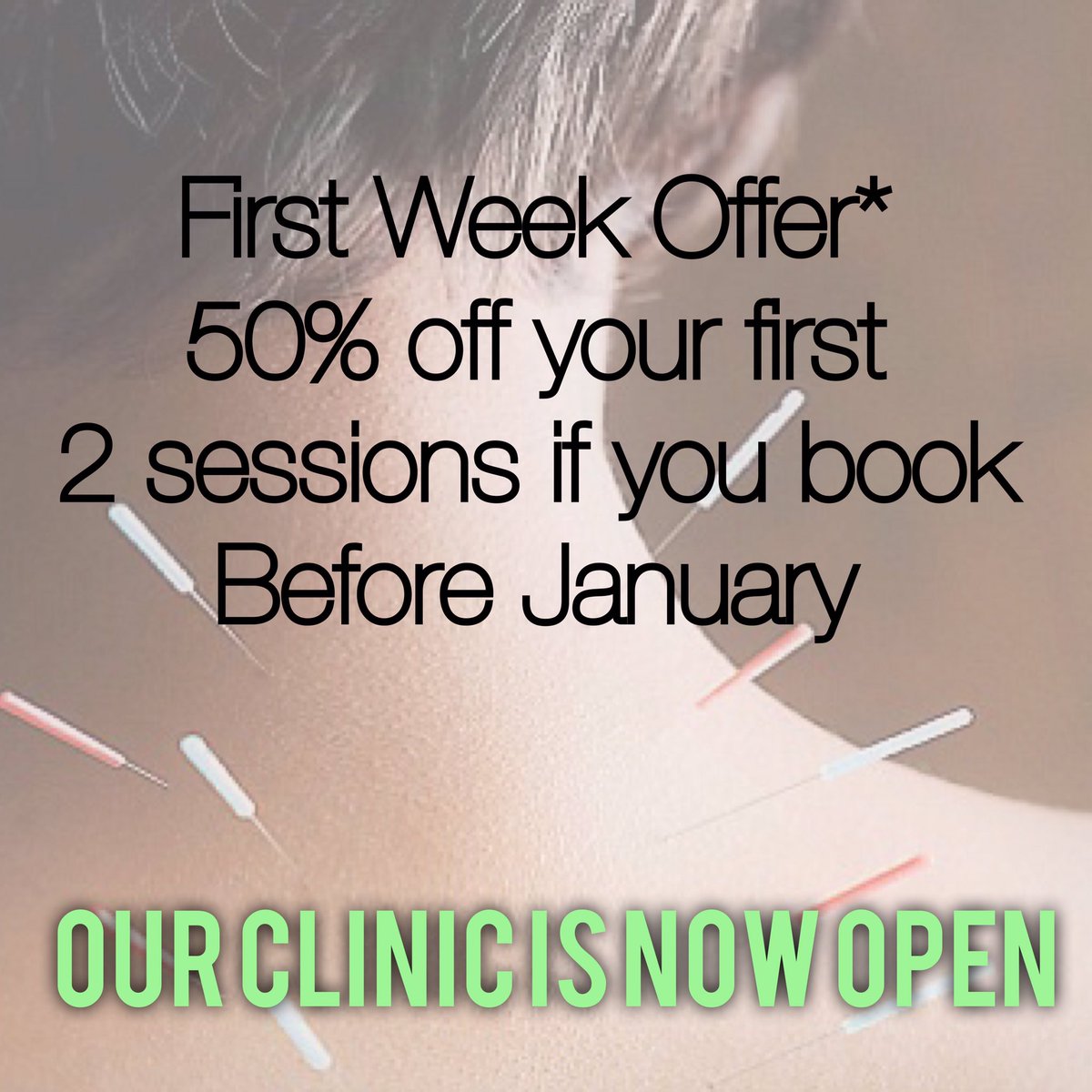 NaturalPathway_'s tweet image. Book in today to receive this great offer #Hessle #Acupuncture #Cosmetic #Health #Nurse #Clinic