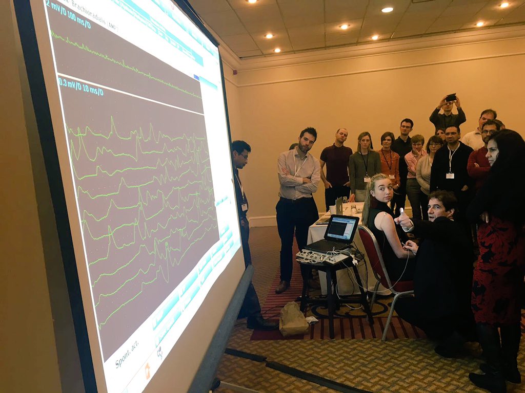 Dr Ronan McDonagh demonstrating how to use a EMG machine #Myositis