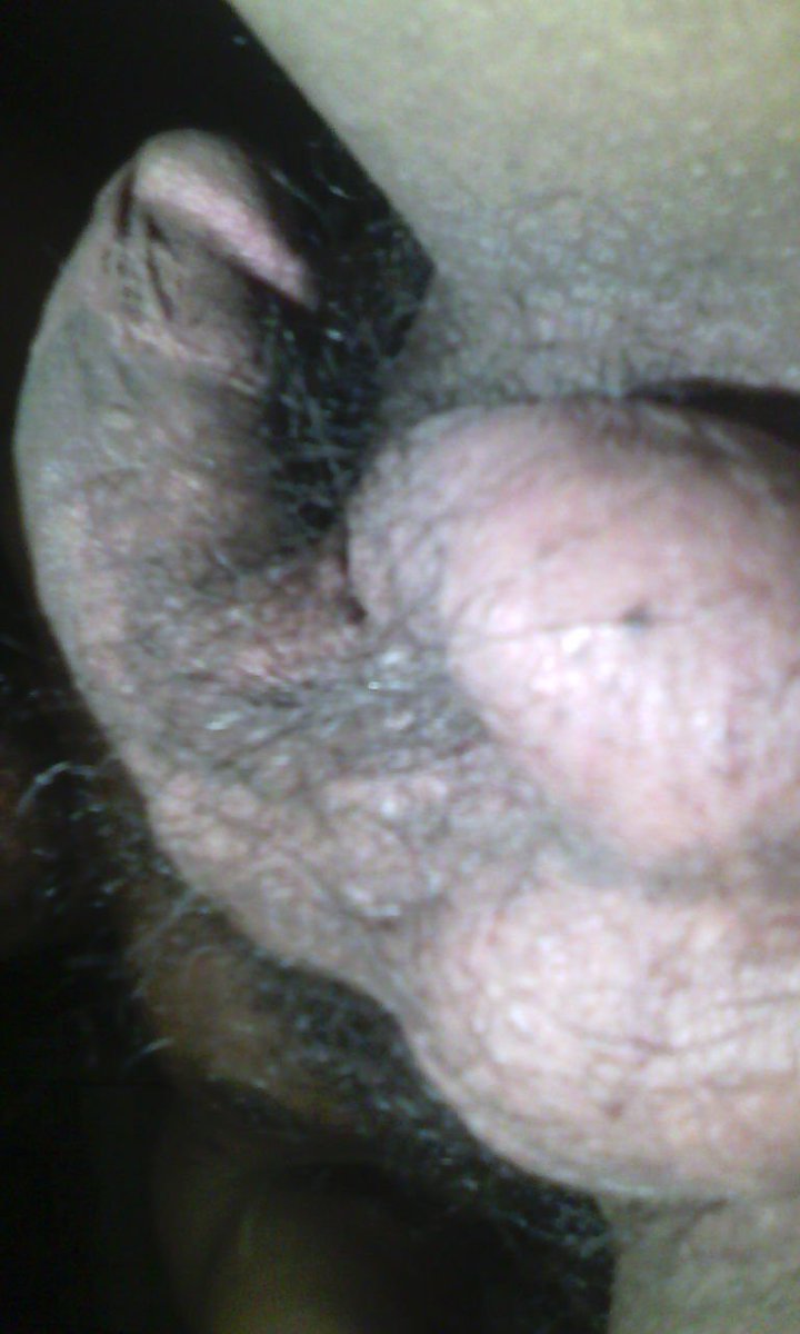 agussup91310330 tweet picture