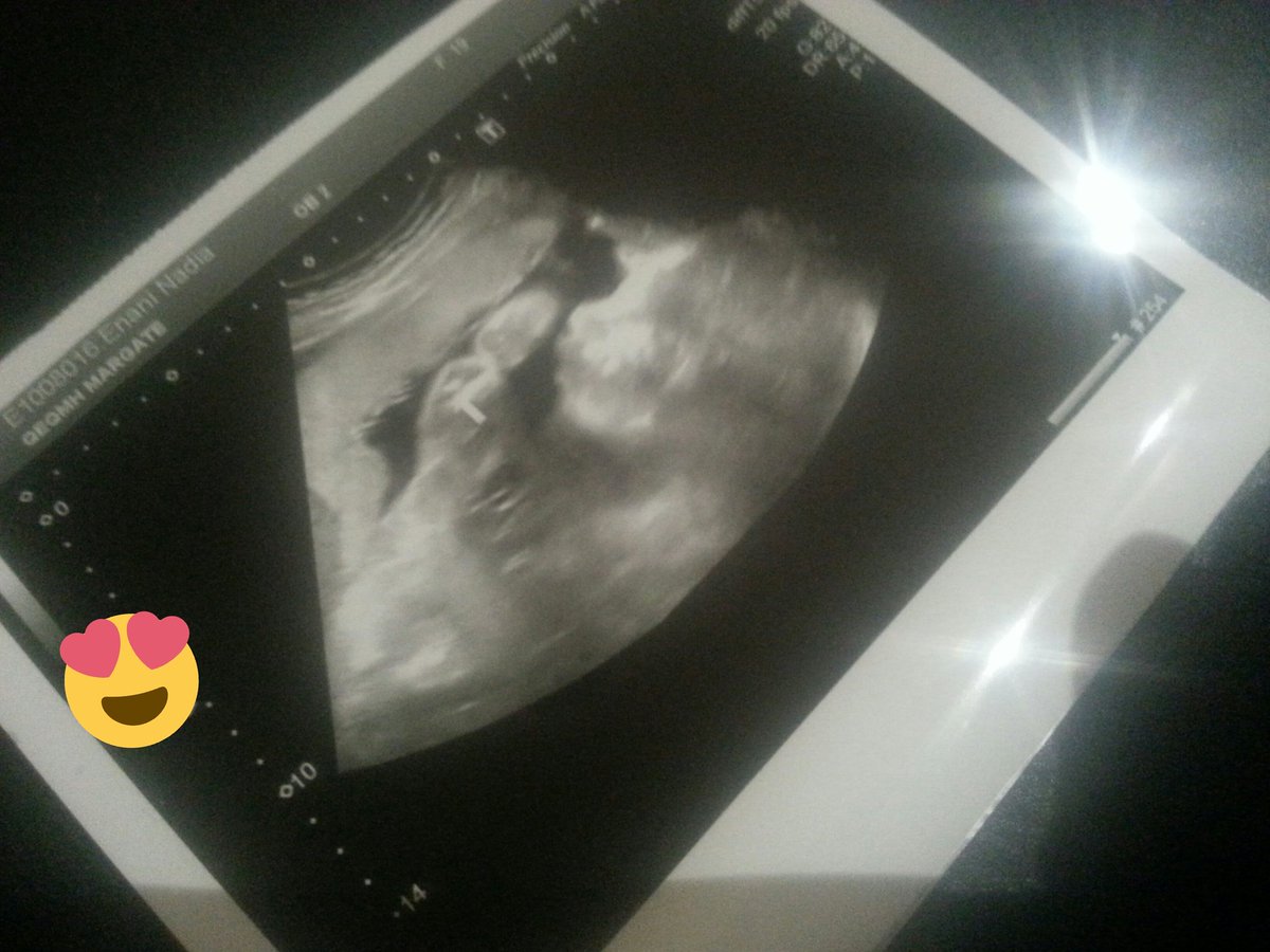 Nadia97Enani's tweet photo. 13 weeks until i can kiss that little face!!♡ https://t.co/6ihMMPmqvc