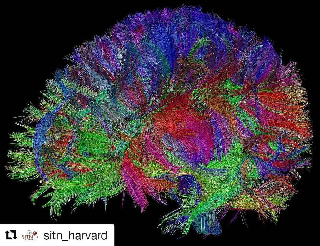 PsyPost's tweet photo. #Repost @sitn_harvard with @repostapp
・・・
Big thanks to @ksitek for this one! #nofilternee… https://t.co/OwoLgENZpx https://t.co/TfhiOSe51T