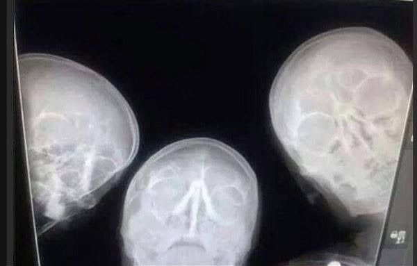 When radiologists take a selfie.