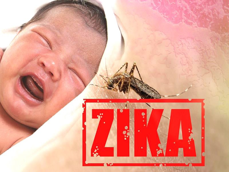 AstrumSalud's tweet image. Los defectos #congénitos por el #Zika son más #abarcadores de lo que se pensaba 

astrumsalud.com/2016/12/16/los…