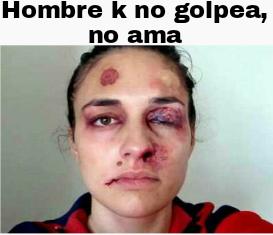 e_eliazar's tweet photo. #SiNoTeGolpeaNoTeAma 
los moretones son señales de amor verdadero @Legion_Holk2 https://t.co/ysIfzOP6Vt