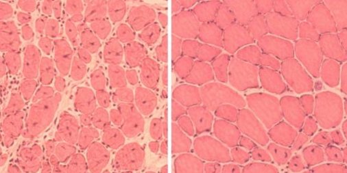 HealthandMed_LR's tweet image. #CellularReprogramming #YamanakaFactors slowed #aging in #mouse model - illustrating #epigenetic influence buff.ly/2htzb7A