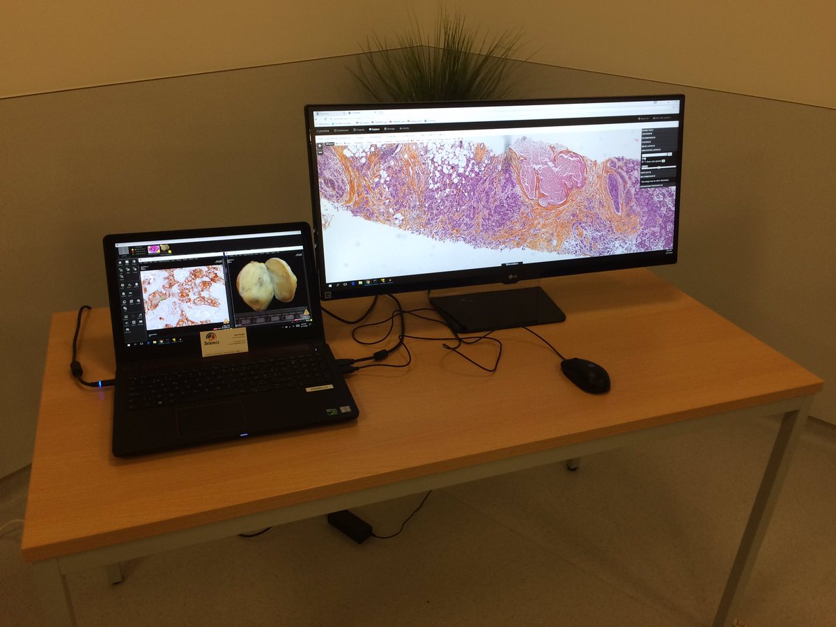 telemis's tweet image. #Telemis et la #digitalPathology au #CHWAPI !