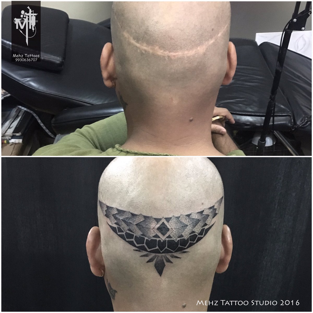 Neck Stitches Tattoo