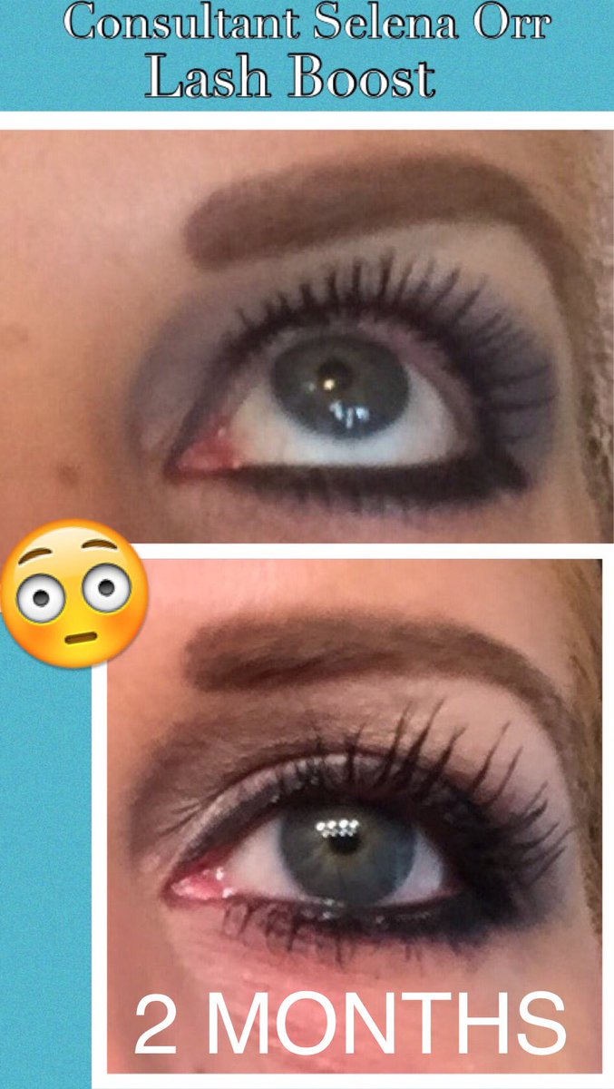 orr_selena's tweet photo. My personal Lash Boost 8 week results!!!😳😆 https://t.co/RN2o2odiHW