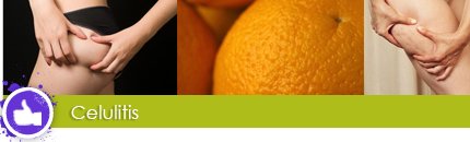 MiFitbook's tweet photo. Celulitis? Infórmate aquí por qué se produce
https://t.co/phUR1RX8pa https://t.co/yoOaxRgi1o