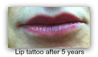 LivelyInk's tweet photo. Holding power !  Lip tattoo after 5 years.  https://t.co/hREPjfRkPf  #fb https://t.co/JCA0GNrxvk