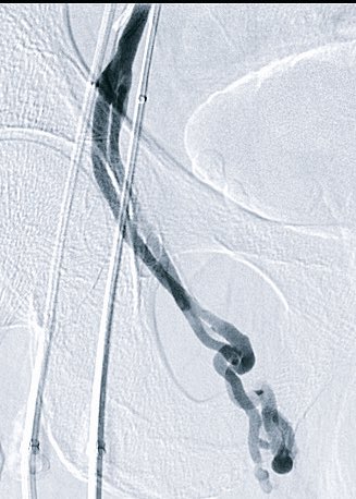 Albany IR tweet media