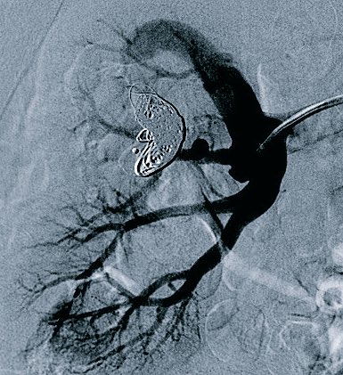 Albany IR tweet media
